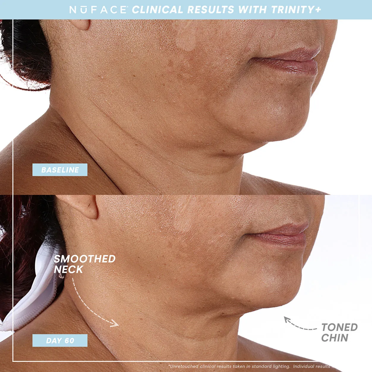Trinity  and Effective Lip and Eye Attachment